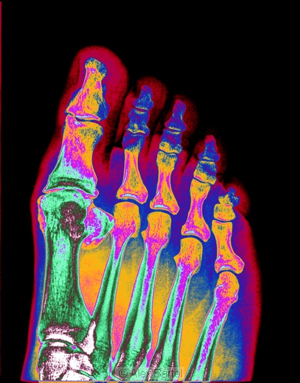 Coloured x-ray, foot
