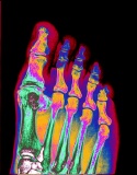Coloured x-ray, foot