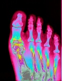 Coloured x-ray, foot